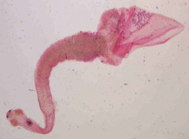 pork from humans was born