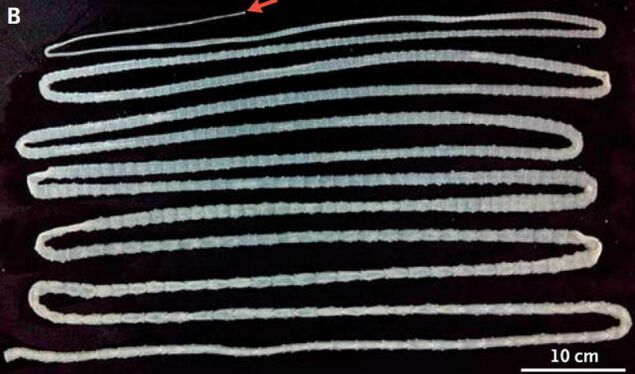 tapeworm from the human body